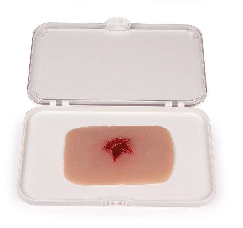 Wundmoulage Schuß Austrittswunde, NW010B - Notemed Medizintechnik 
