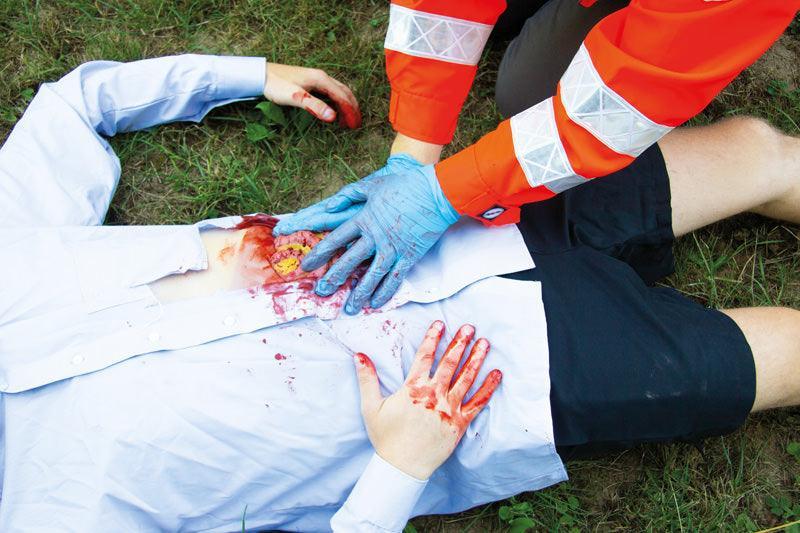Wundmoulage Dünndarmaustritt, NW111 - Notemed Medizintechnik 