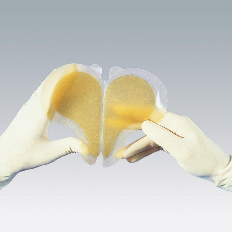 Hydrocoll sacral,12 x 18 cm, steril, einzeln eingesiegelt, spezifische Zuschnitt zur Behandlung von Dekubitalulzerationen im Sakralbereich, 900755 - Notemed Medizintechnik 