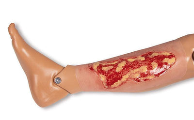 Wundmoulage Ulcus Cruris Venosum, groß, Exsudationsphase, PW003A - Notemed Medizintechnik 