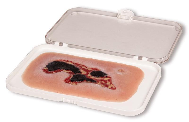 Wundmoulage Ulcus Cruris Arteriosum, klein, Exsudationsphase, PW004A - Notemed Medizintechnik 
