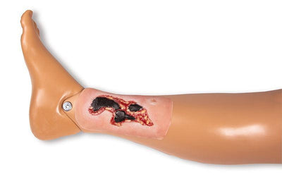 Wundmoulage Ulcus Cruris Arteriosum, klein, Exsudationsphase, PW004A - Notemed Medizintechnik 