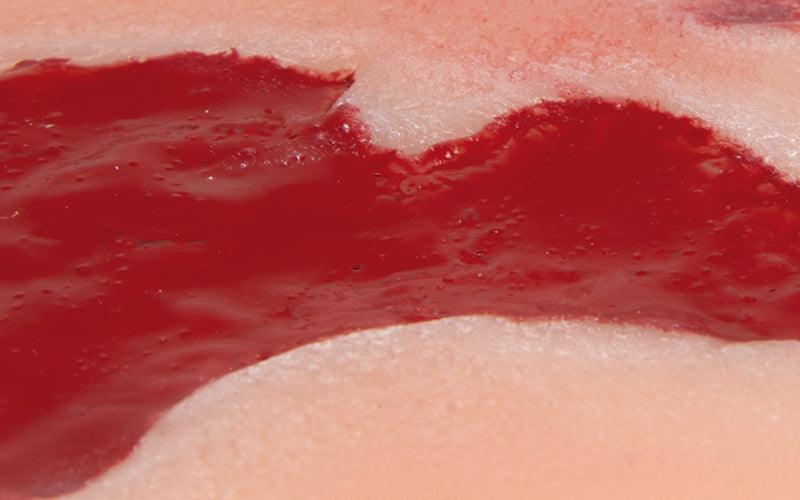 Wundmoulage Ulcus Cruris Arteriosum, klein, Granulationsphase, PW004B - Notemed Medizintechnik 
