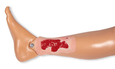 Wundmoulage Ulcus Cruris Arteriosum, klein, Granulationsphase, PW004B - Notemed Medizintechnik 