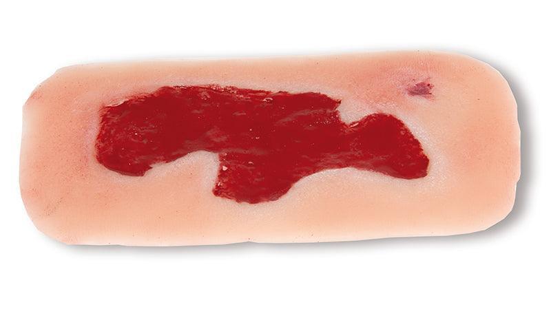 Wundmoulage Ulcus Cruris Arteriosum, klein, Granulationsphase, PW004B - Notemed Medizintechnik 