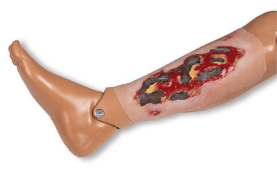 Wundmoulage Ulcus Cruris Arteriosum, groß, Exsudationsphase, PW005A - Notemed Medizintechnik 