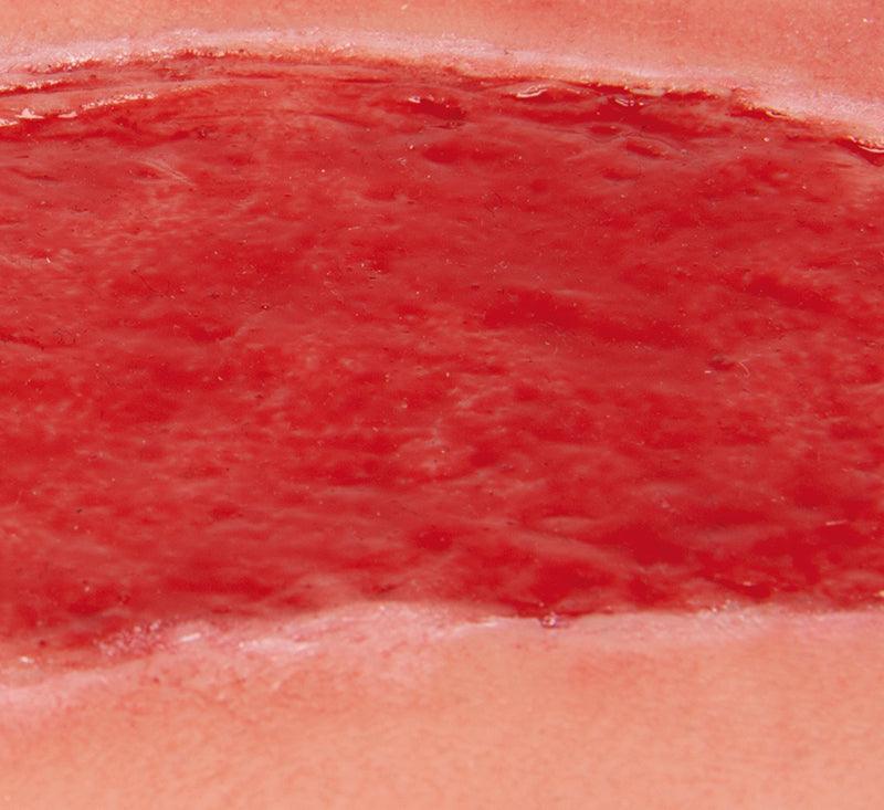 Wundmoulage Ulcus Cruris Arteriosum, groß, Granulationsphase, PW005B - Notemed Medizintechnik 
