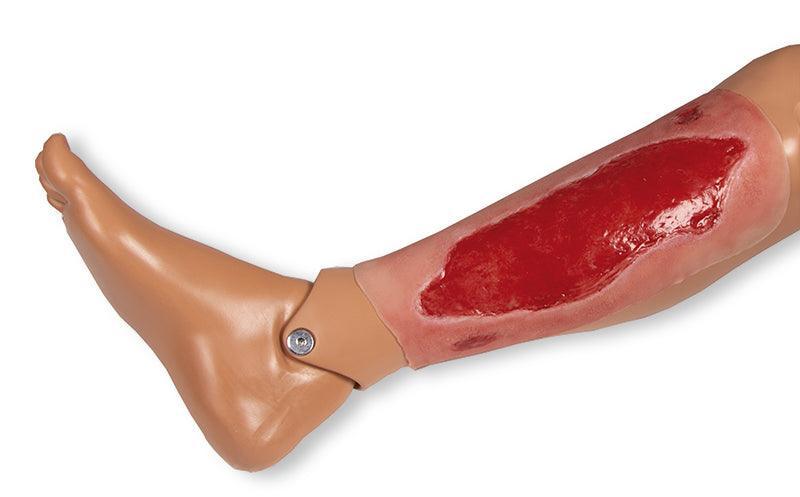 Wundmoulage Ulcus Cruris Arteriosum, groß, Granulationsphase, PW005B - Notemed Medizintechnik 