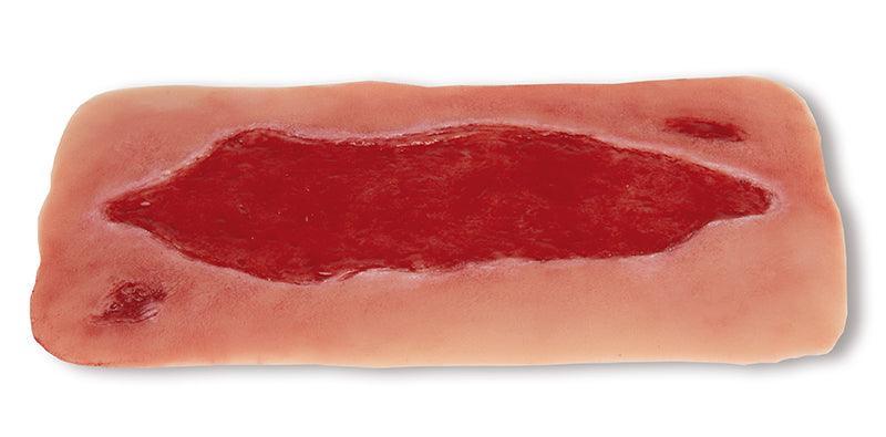 Wundmoulage Ulcus Cruris Arteriosum, groß, Granulationsphase, PW005B - Notemed Medizintechnik 