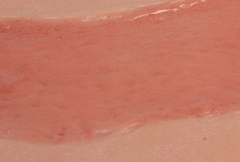 Wundmoulage Ulcus Cruris Arteriosum, groß, Epithelisierungsphase, PW005C - Notemed Medizintechnik 