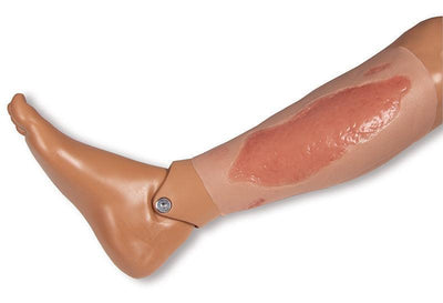 Wundmoulage Ulcus Cruris Arteriosum, groß, Epithelisierungsphase, PW005C - Notemed Medizintechnik 