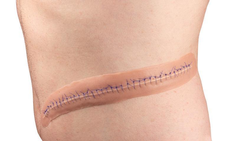OP Wunde, mit Naht, 22cm, PW009B - Notemed Medizintechnik 