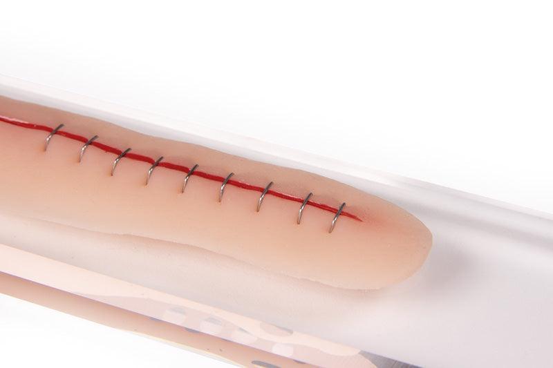 OP Wunde, geklammert, 22cm, PW009C - Notemed Medizintechnik 