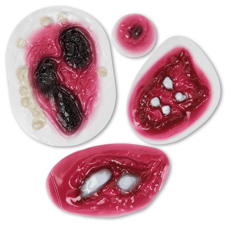 Wundensimulations-Set Multi, R10043 - Notemed Medizintechnik 