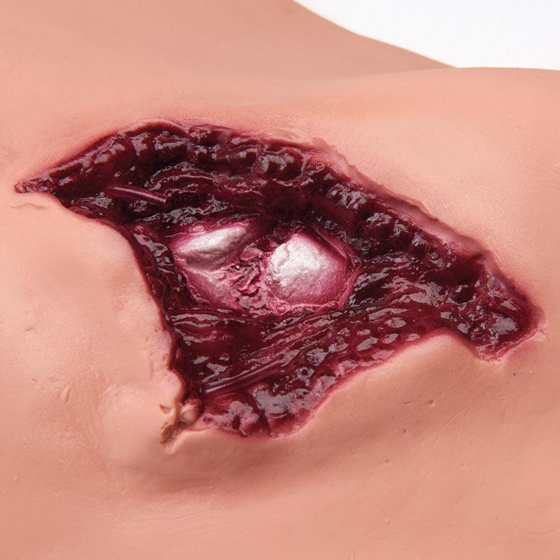 Wundensimulations-Set Multi, R10043 - Notemed Medizintechnik 