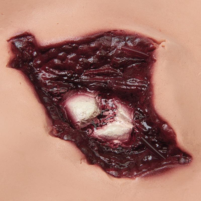 Wundsimulations-Set für Puppen, R10046 - Notemed Medizintechnik 