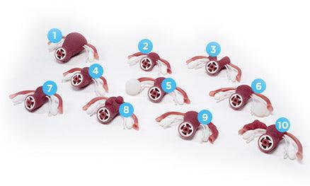 Uteri mit externen tastbaren abnormalen Patholgien für R10188, R10188-1 - Notemed Medizintechnik 