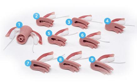 Uteri mit normalen und abnormalen inneren Pathologien für R10188, R10188-2 - Notemed Medizintechnik 