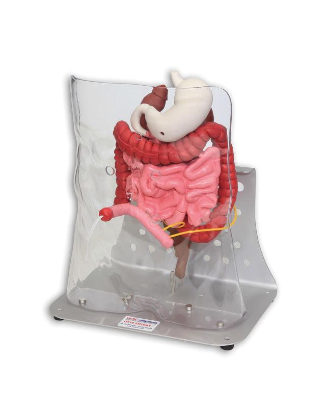 Otto Ostomy, erweitert, R11009 - Notemed Medizintechnik 
