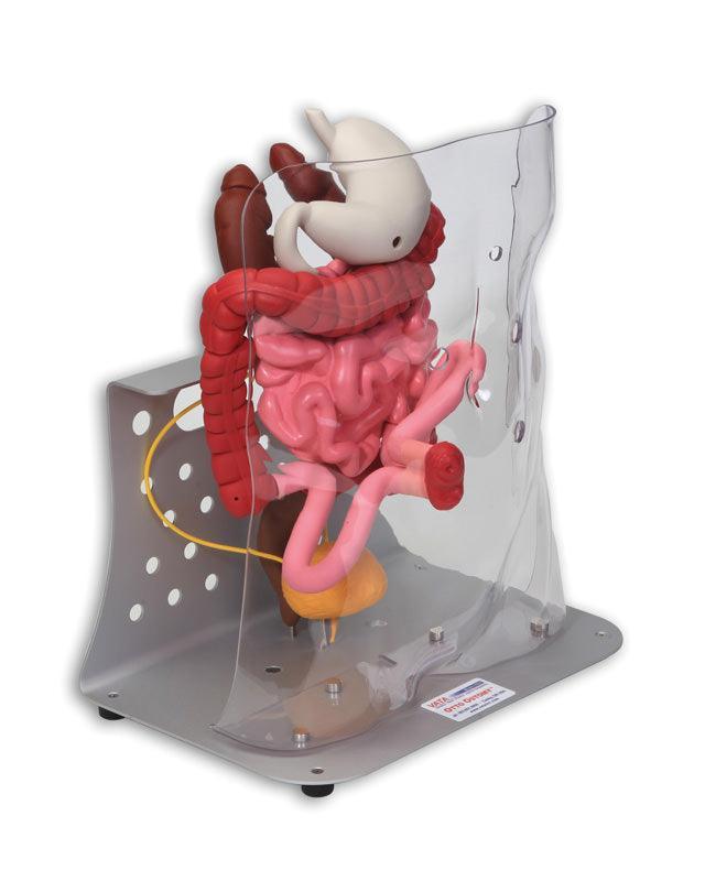 Otto Ostomy, erweitert, R11009 - Notemed Medizintechnik 