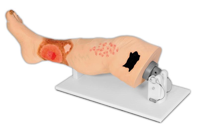 Vinnie, Bein mit venöser Insuffizienz, R11020 - Notemed Medizintechnik 