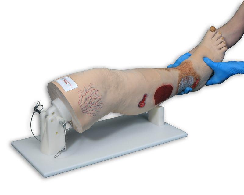 Vinnie, Bein mit venöser Insuffizienz, R11020 - Notemed Medizintechnik 