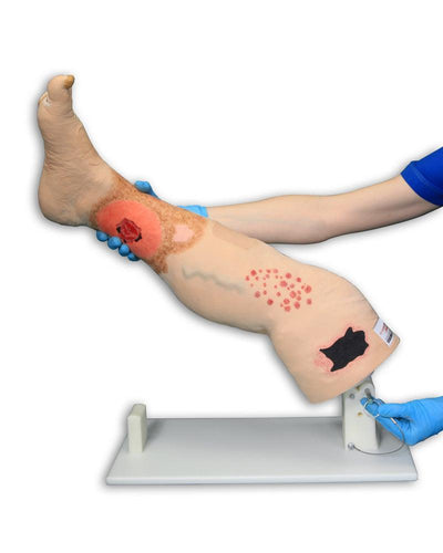 Vinnie, Bein mit venöser Insuffizienz, R11020 - Notemed Medizintechnik 
