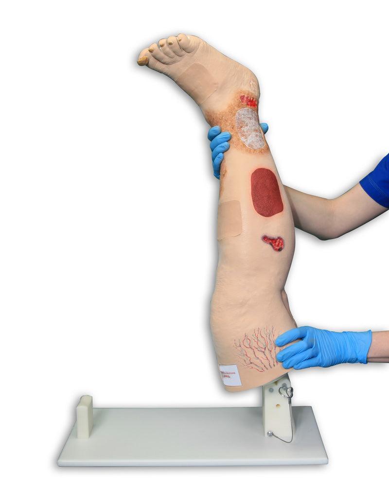 Vinnie, Bein mit venöser Insuffizienz, R11020 - Notemed Medizintechnik 