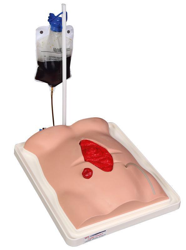 Freddie Fistula Übungsmodell mit Koffer, R11050 - Notemed Medizintechnik 