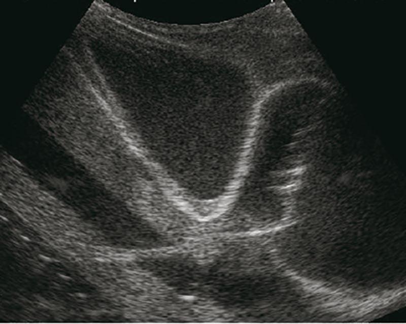 Perikardiozentese Simulator mit Ultraschallunterstützung, R16012 - Notemed Medizintechnik 