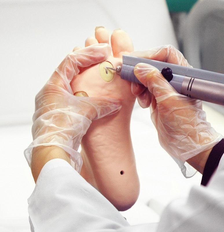 Übungsmodell medizinische Fußpflege, R16080 - Notemed Medizintechnik 