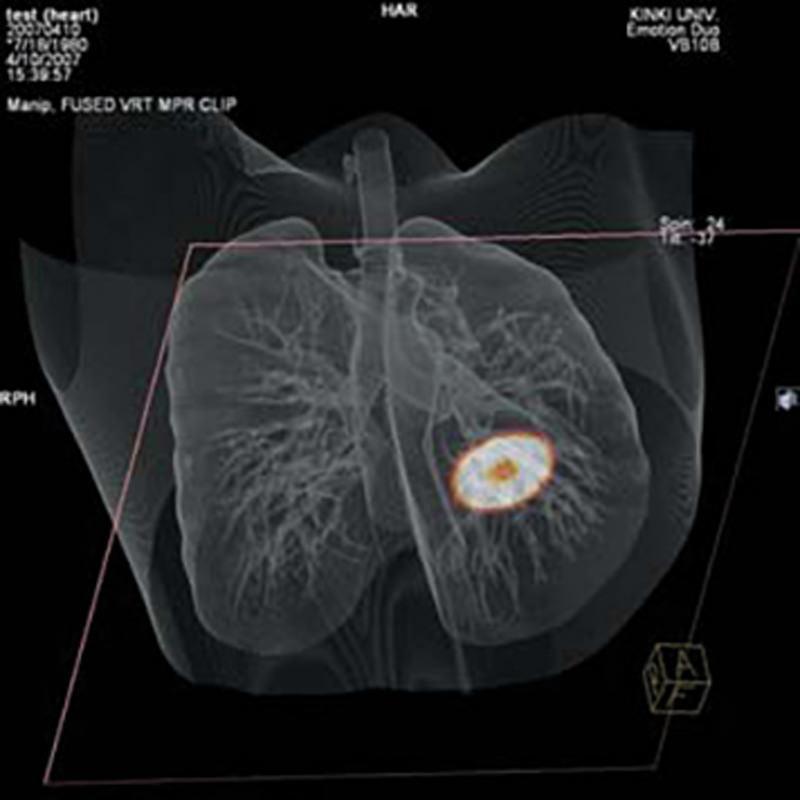 Leber RI Behälter für Radioisotope für R16511, R16511-2 - Notemed Medizintechnik 