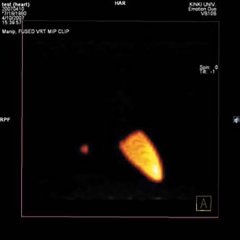 Gallenblase RI Behälter für Radioisotope für R16511, R16511-3 - Notemed Medizintechnik 