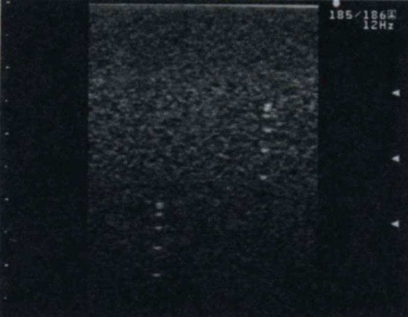 Vielzweck-Phantom, R16543 - Notemed Medizintechnik 
