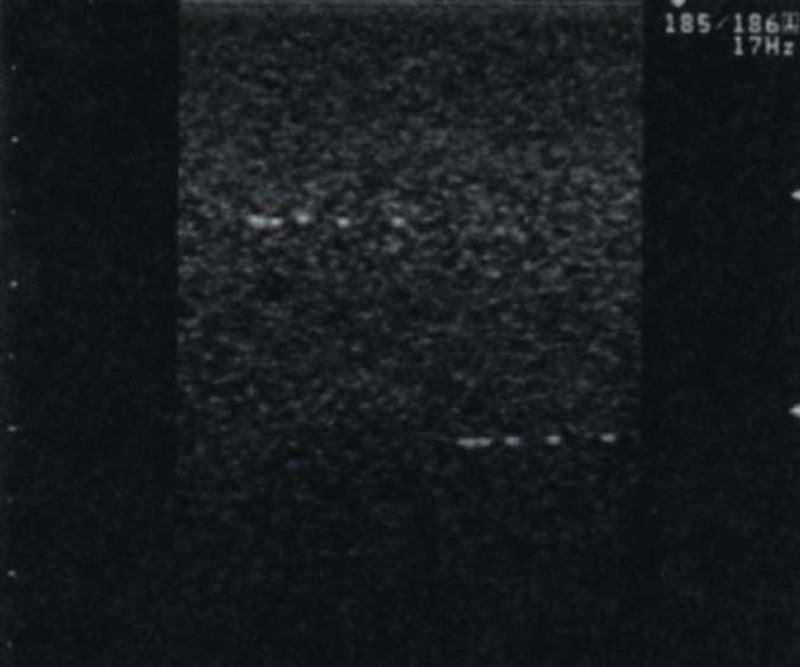 Vielzweck-Phantom, R16543 - Notemed Medizintechnik 