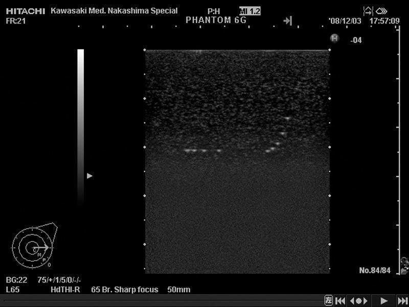 Brust-Phantom, R16546 - Notemed Medizintechnik 