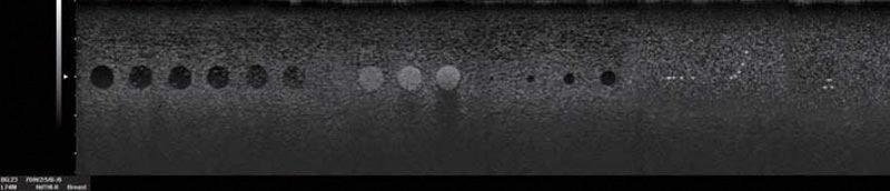 Brust-Phantom, R16546 - Notemed Medizintechnik 