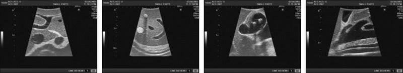 Ultraschall-Modell für Sonografie, R16550 - Notemed Medizintechnik 