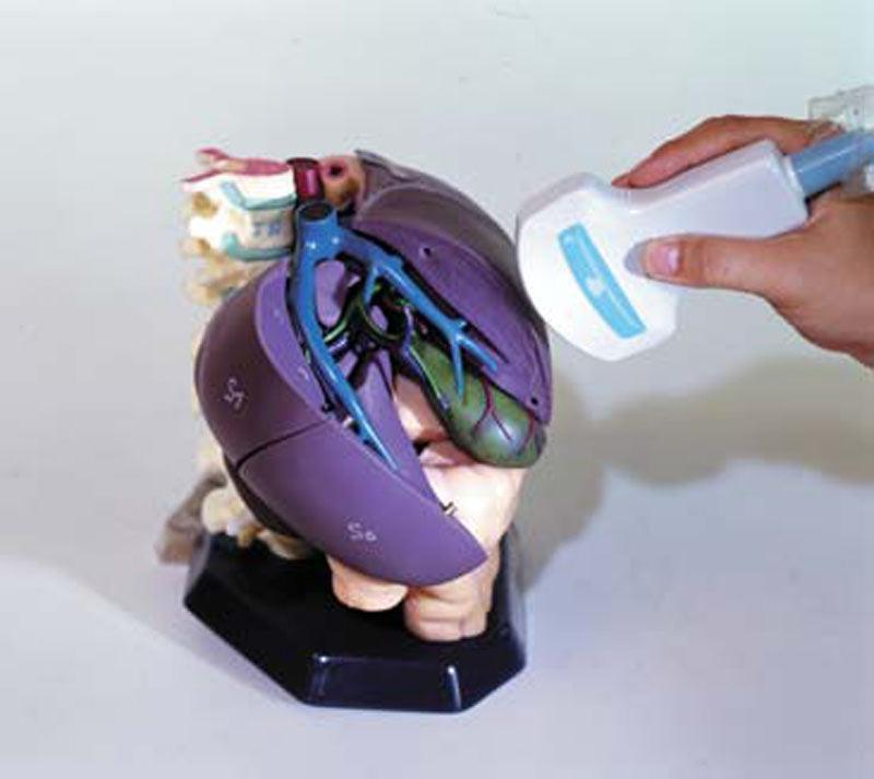Anatomisches Modell für Ultraschallausbildung, R16580 - Notemed Medizintechnik 