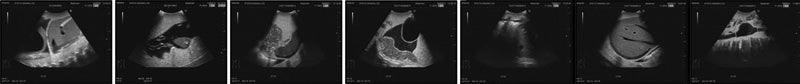 FAST-Ultraschall-Untersuchungsmodell, R16590 - Notemed Medizintechnik 