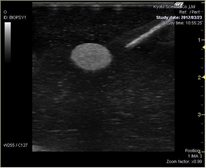 Ultraschallgestütztes Brustbiopsie-Phantom (Set mit einer basis und einer erweiterten Version), R16675 - Notemed Medizintechnik 