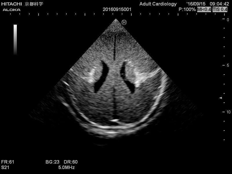 Neonatales Ultraschall-Übungsphantom Kopf, R16800 - Notemed Medizintechnik 