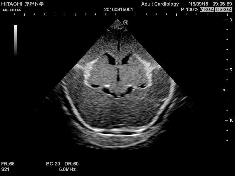 Neonatales Ultraschall-Übungsphantom Kopf, R16800 - Notemed Medizintechnik 