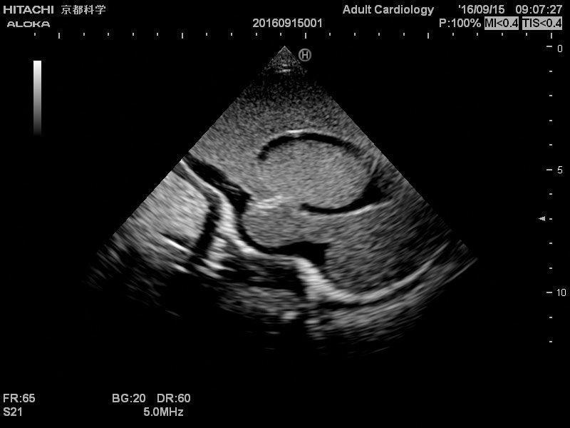 Neonatales Ultraschall-Übungsphantom Kopf, R16800 - Notemed Medizintechnik 
