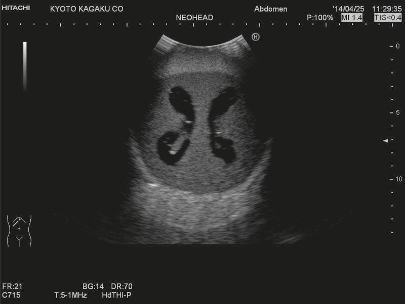 Neonatales Ultraschall-Übungsphantom Kopf mit Hydrocephalus, R16810 - Notemed Medizintechnik 