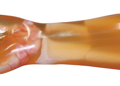 Frakturenhand mit Unterarm für R16900, R16900-1 - Notemed Medizintechnik 