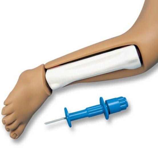 Intraossäres Bein für R17700, R17700-2 - Notemed Medizintechnik 