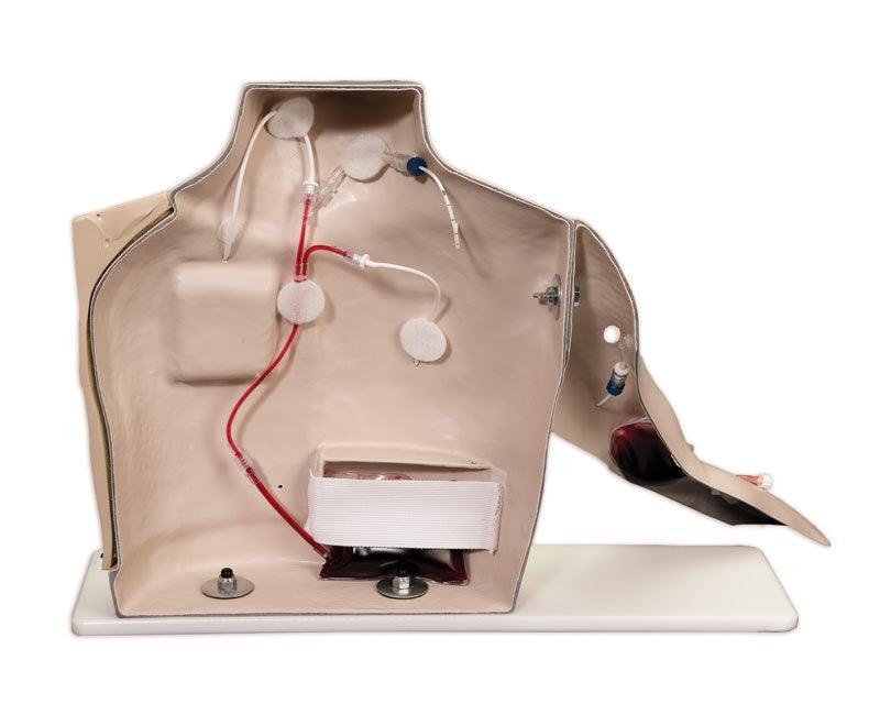 Chester Chest mit erweitertem Arm, R18803 - Notemed Medizintechnik 