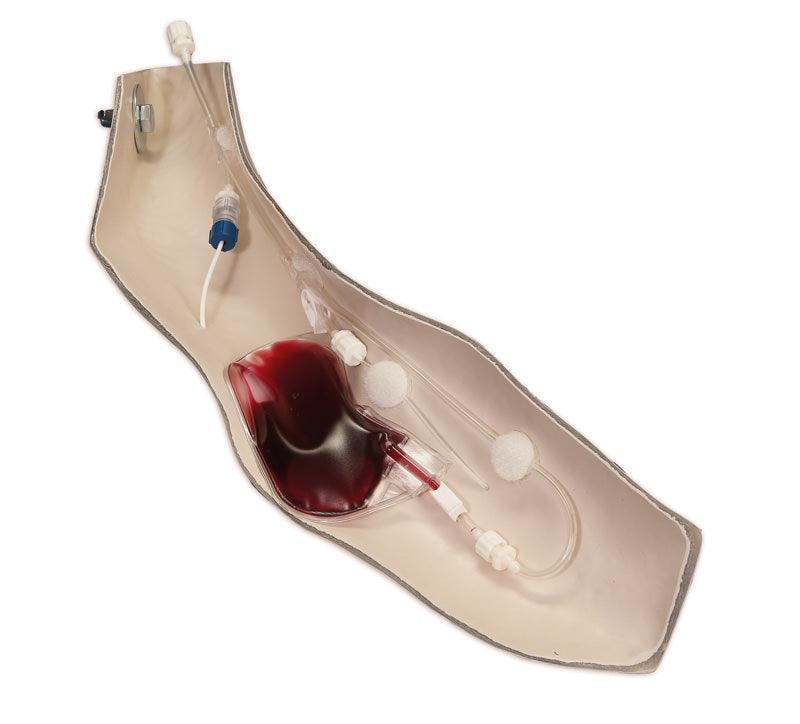 Chester Chest mit erweitertem Arm, R18803 - Notemed Medizintechnik 