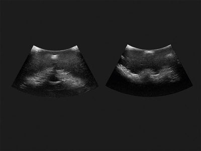 Epidural- und Spinalinjektionssimulator Genesis, R66600 - Notemed Medizintechnik 